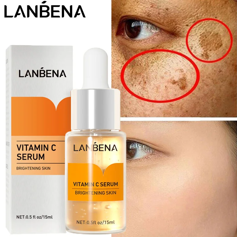 Vitamin C Whiten Serum Brighten Anti-Freckles Remove Melanin Wrinkles Reduce Pigmentation Moisturizing Smooth Skin Care_voghion.com
