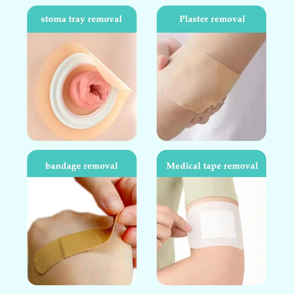 2pcs 30ML Colostomy Adhesive Wipe-Off Spray Medical Adhesive Remover Ostomy Bag Care Products