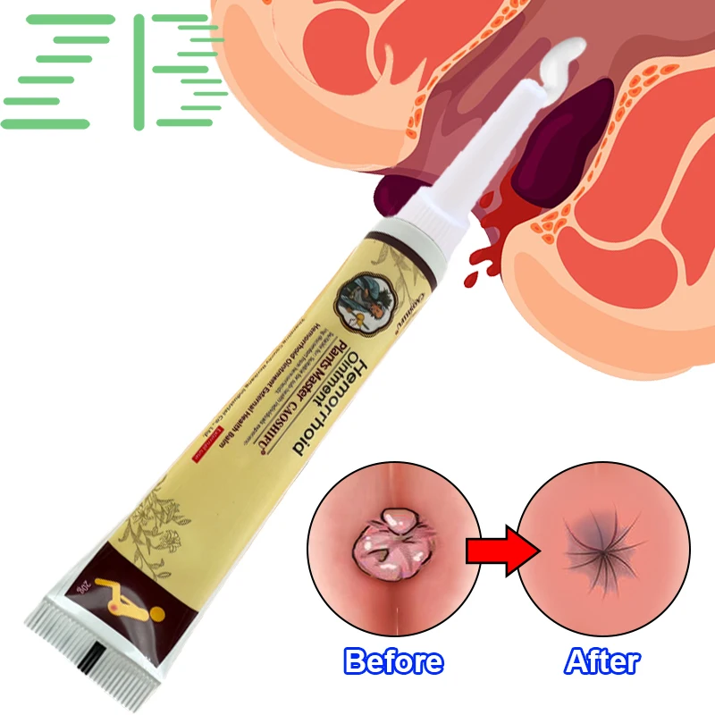 Hemorrhoid ointment extracted from natural Chinese herbal medicine, clinically relieving itching and inflammation, and healing