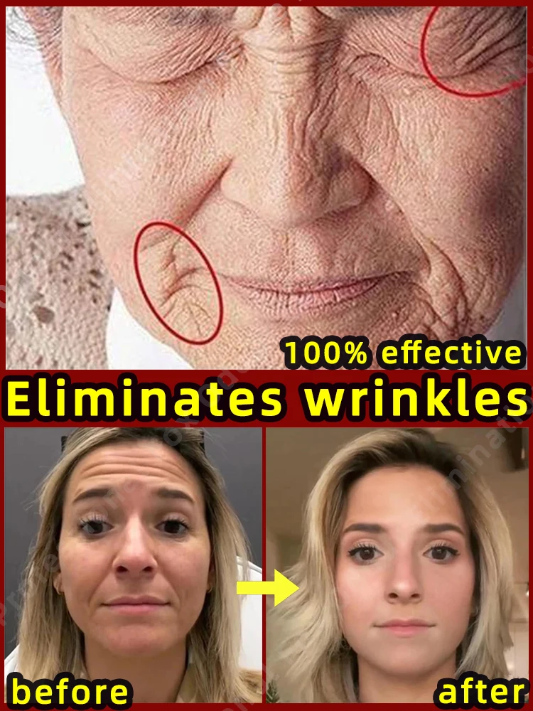 

Anti-wrinkle Serum Remove Face Neck Forehead Wrinkles Anti-aging Skin Firming