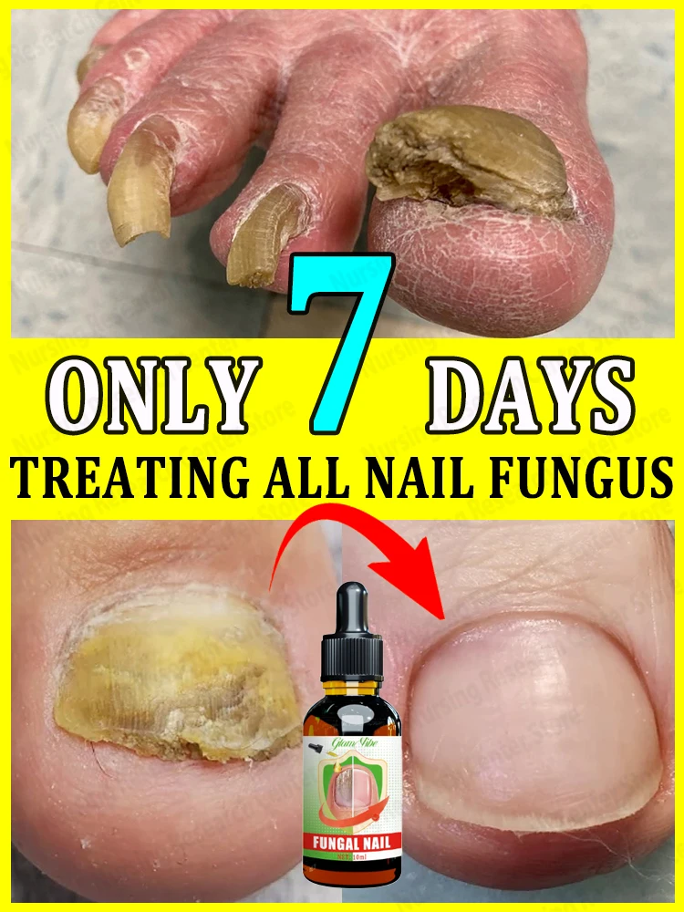 Foot Serum with Organic Essential Oil 7-Day Repair