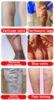 Varicose Vein Lampshade Therapy Effective Relief Of Dilated Vasculitis In The Legs Phlebitis Improved Blood Circulation New 6