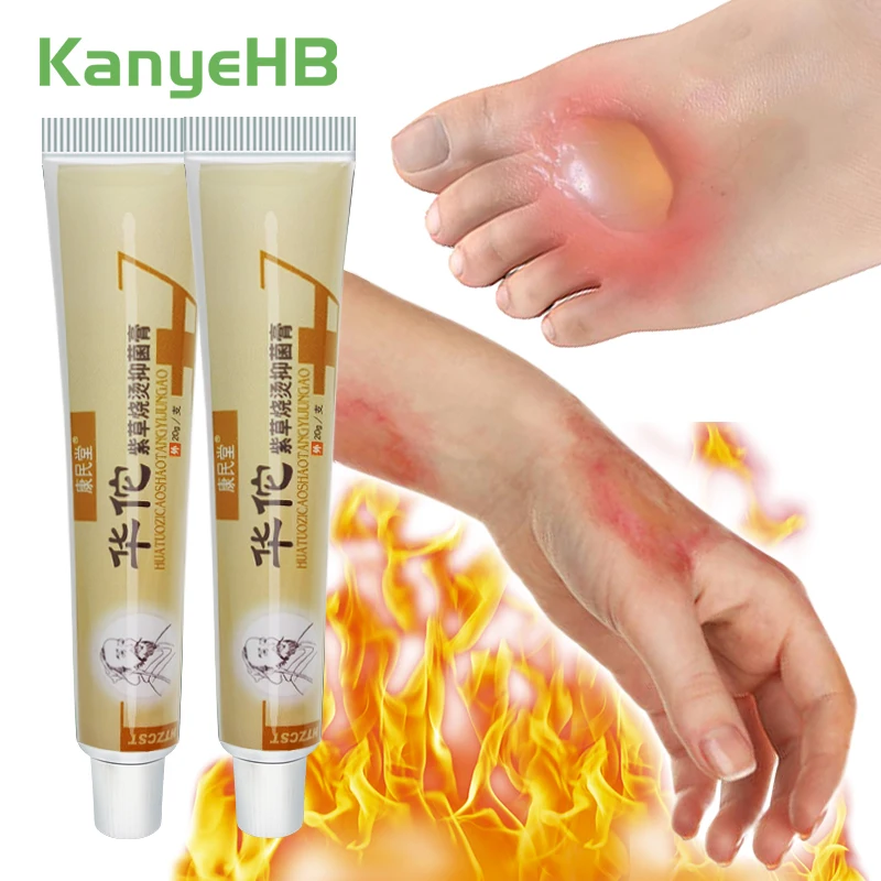 

2pcs Burn Scald Ointment Burn Treatment Cream Relieve Burn Scars Promote Skin Healing Inhibit Fungi Burn Medical Plaster A262