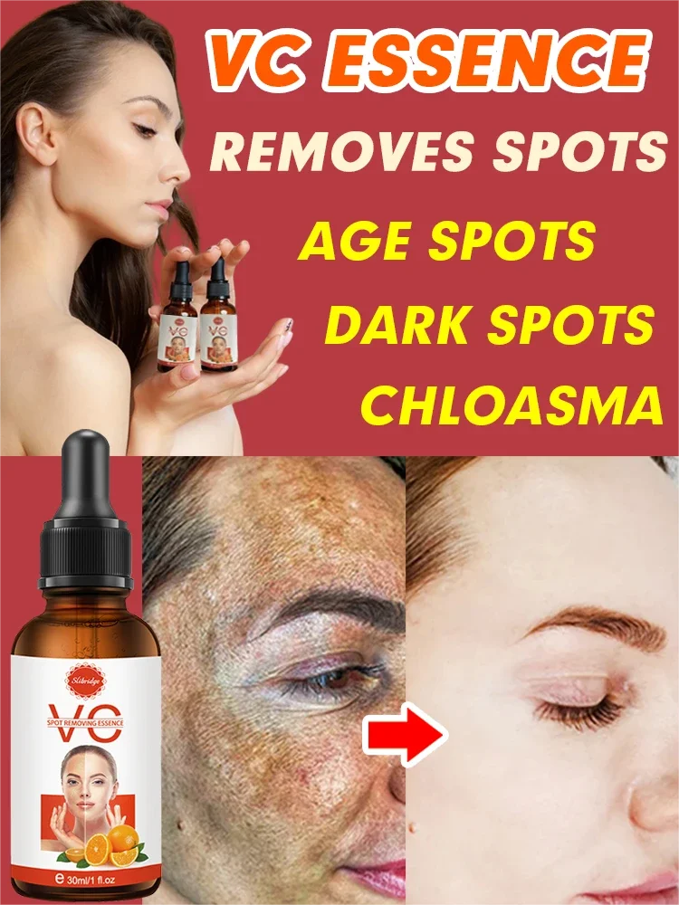 

Dark Spot Remover For Face Sun Melasma Freckles Pigment Age Spots Removal