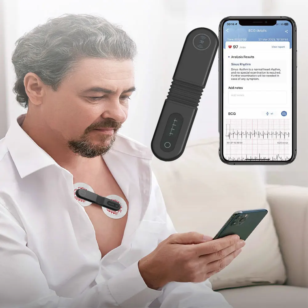 AI Holter ECG Monitoring Wearable Bluetooth EKG 24h Real-time Dynamic ECG monitor 17 abnormal patterns Screen display ecg monitor