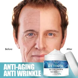 Anti-wrinkle Cream For Men Remove Face Neck Wrinkles Firming Moisturizing Skin Retinol Face Cream Anti-aging Facial Skin Product