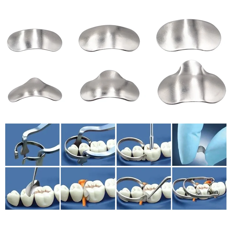 100x Matrices Dentales Bandas de matriz de metal contorneadas