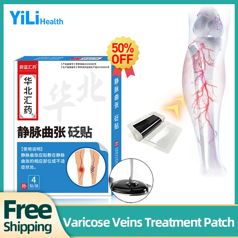 Varicose Veins Treatment Patch Varicocele Vein Spider Legs Removal Vasculitis Phlebitis Vulvar Varicosity Repair Medicine