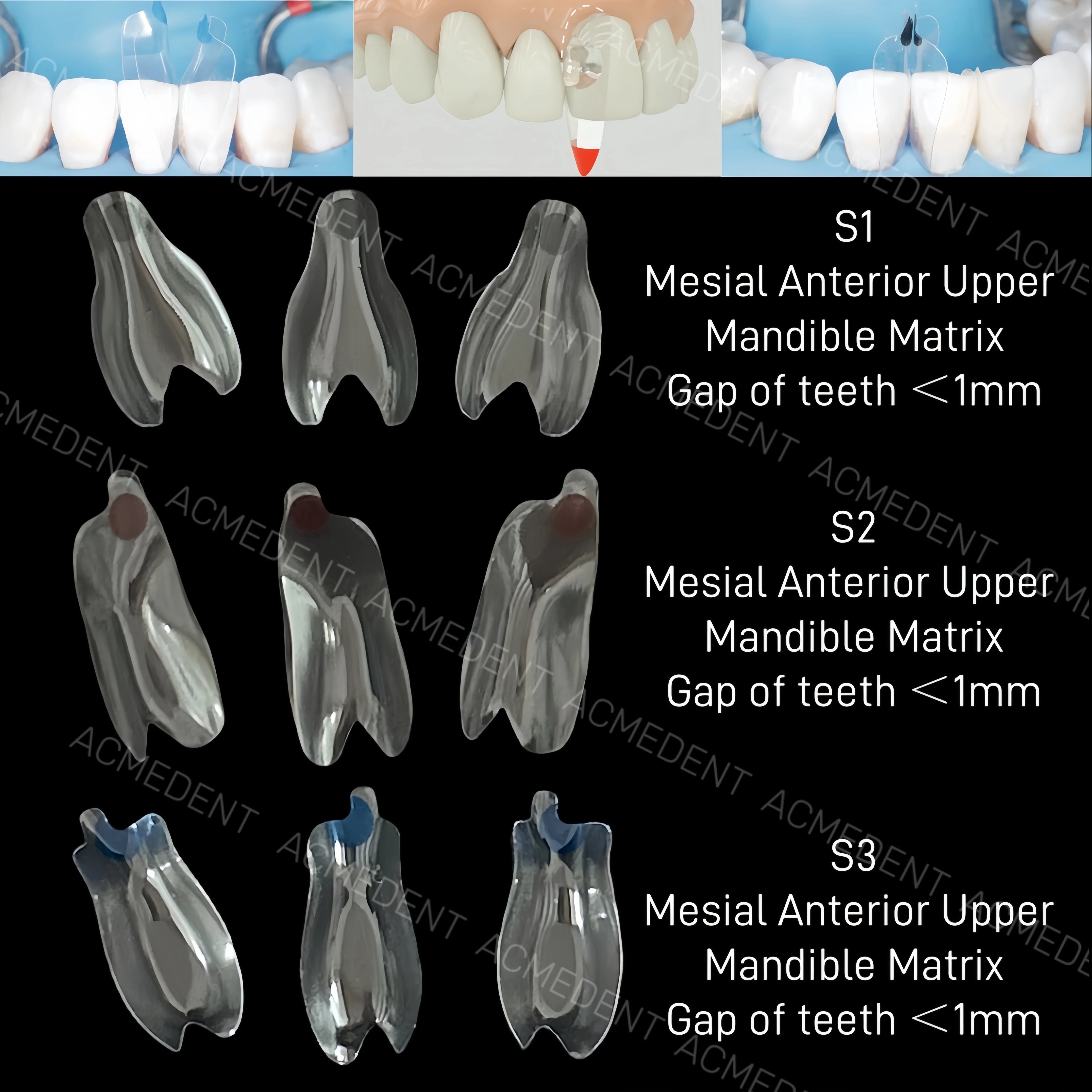 Dental Matrix Universal Retainers Bioclear Anterior Matrix Refills ...