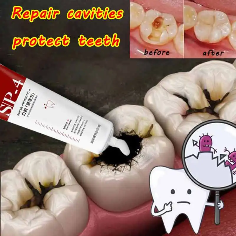 

100 Probiotic Caries Toothpaste SP4 Whitening Repair Tooth Decay Paste Cleaner Teeth Remover Plaque Fresh Breath Oral Care