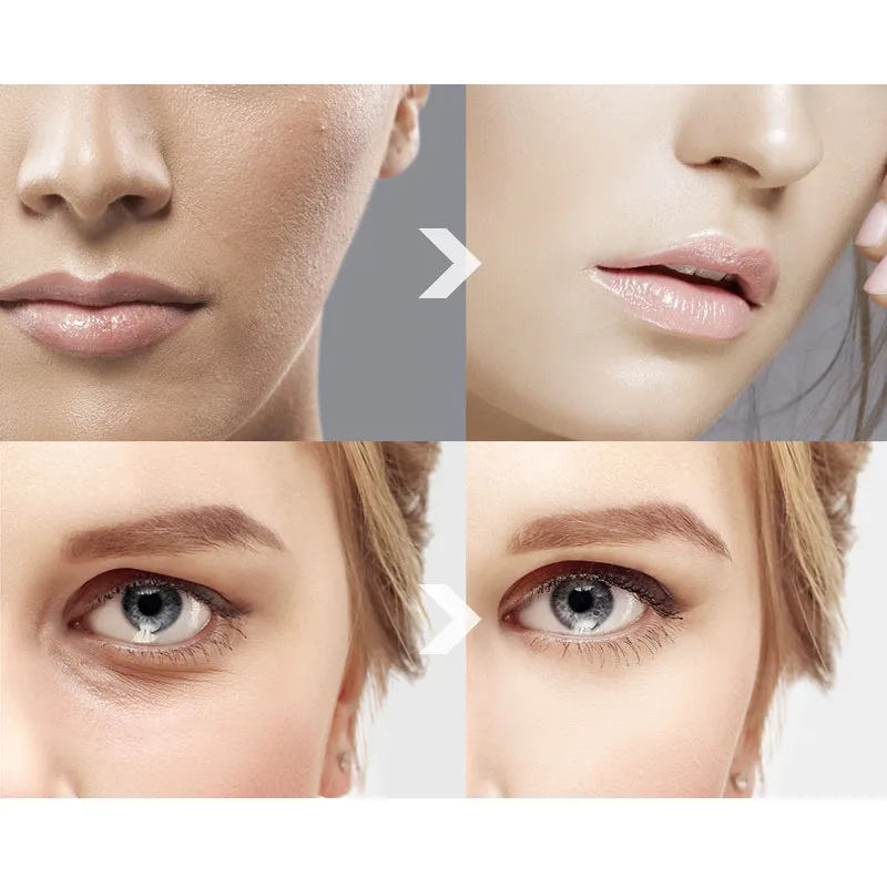 20/50/60/100pcs Hyaluronic Acid Capsules Serum VE Anti-aging Spot Acne Remover Whitening Face Cream Anti-Wrinkle Serum,facial serum,facial essence,whitening serum,facial anti wrinkles product