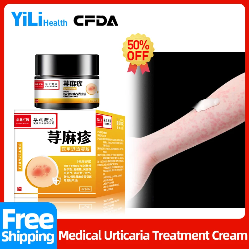 UrticariaPorPielTreatmentCreamApplyToEczemaAcuteChronic