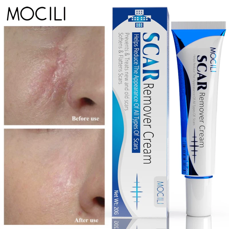 

Scar Remover Cream Stretch Marks Care Pimples Spots Repair Whitening Moisturizer Fade Scars Smooth Beauty Skin Care 20g