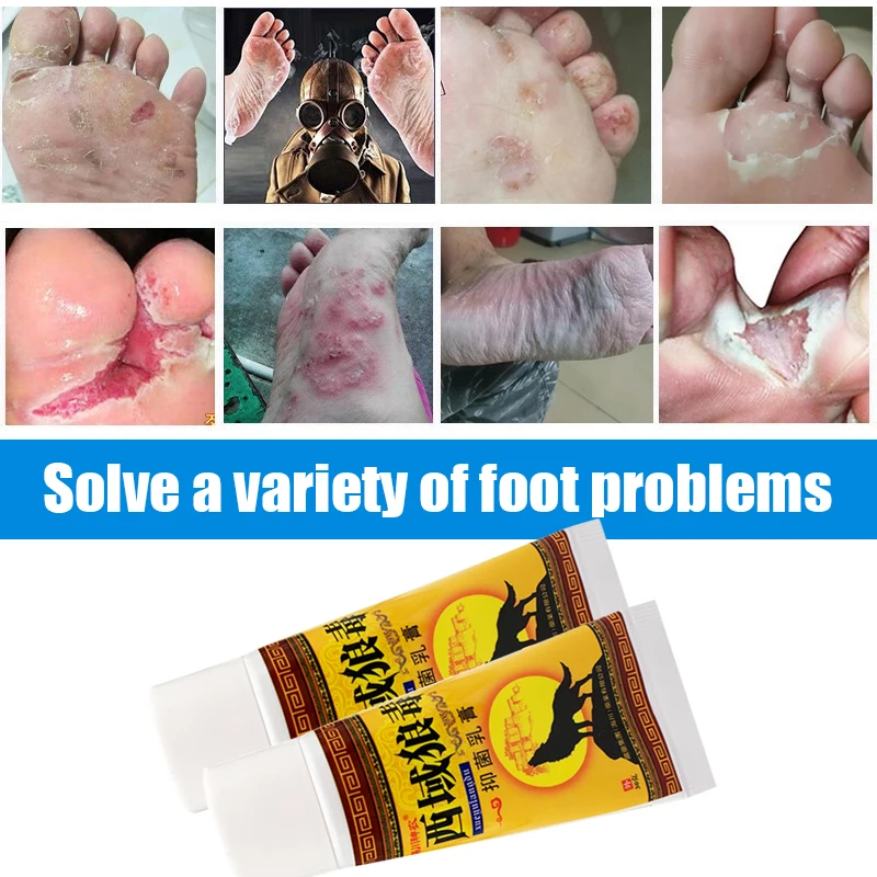 

30g Foot Odor Ointment Treat Curing Beriberi Tinea Pedis Ulceration Dressing Inhibits Fungus Foot Antipruritic Herb Care Cream