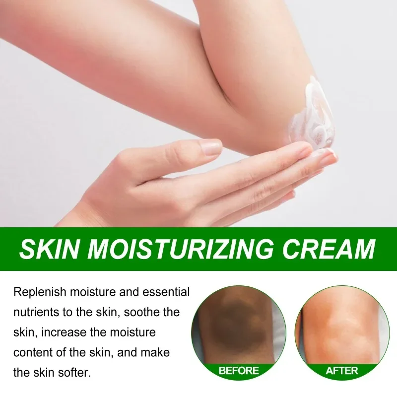 Effective Brightening Body Cream Armpit Legs Knee Elbow Bleaching Cream For Dry Skin Knuckles Lighten Dull Hand Skincare 4 size 4