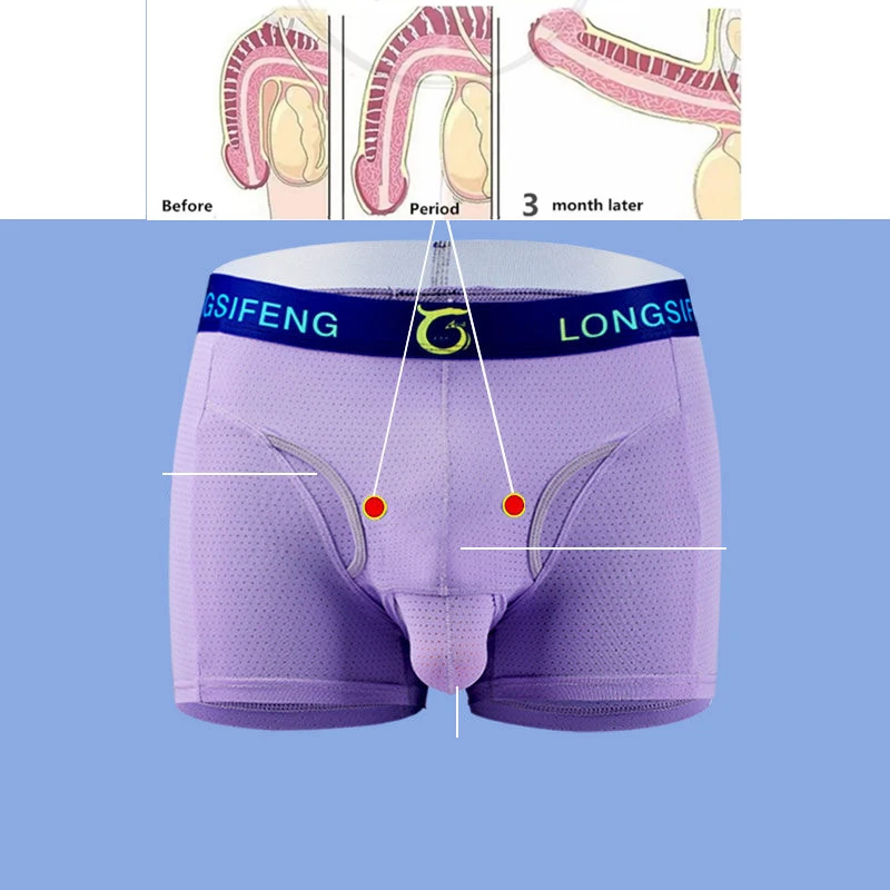 Man Magnetic Underwear Weak Magnet Sexy Boxers Bulge Penis Pouch Health Care Varicocele Cure Lingerie Gay Front Hole Briefs Slip