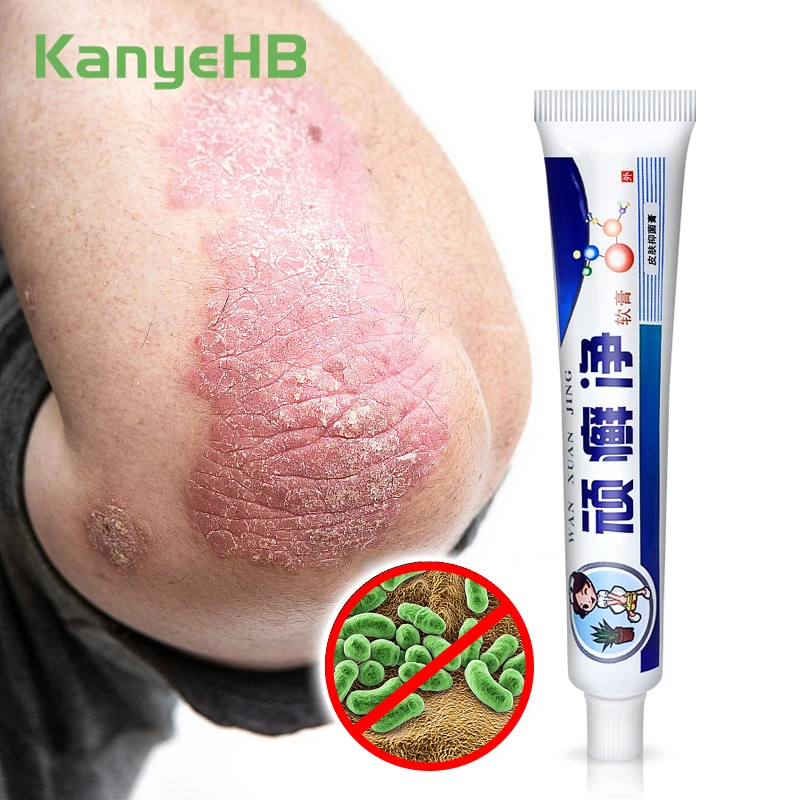 

1pcs Psoriasis Skin Cream Anti-itch Anti-fungal Cream Herbal Dermatitis Eczema Ointment Repair Skin Beriberi Tinea Cruris S016