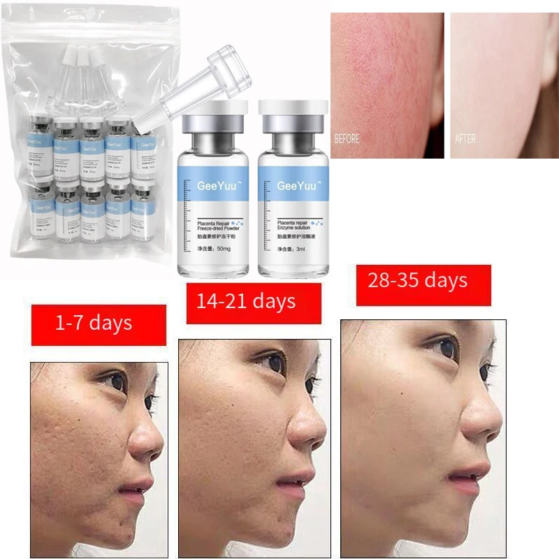Oligopeptide Placenta Freeze-dried Powder Essence Repair Facial Moisturiz Hydrating Pore Shrinkage Skin Rejuvenation Skin Care 2