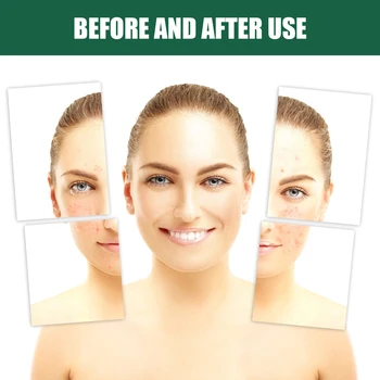 Facial Cleansing Bar Gentle Wormwood Face Wash Bar Soap Natural Herb Bar Soap Wormwood Soap Bar For Face & Body Cleaning 3