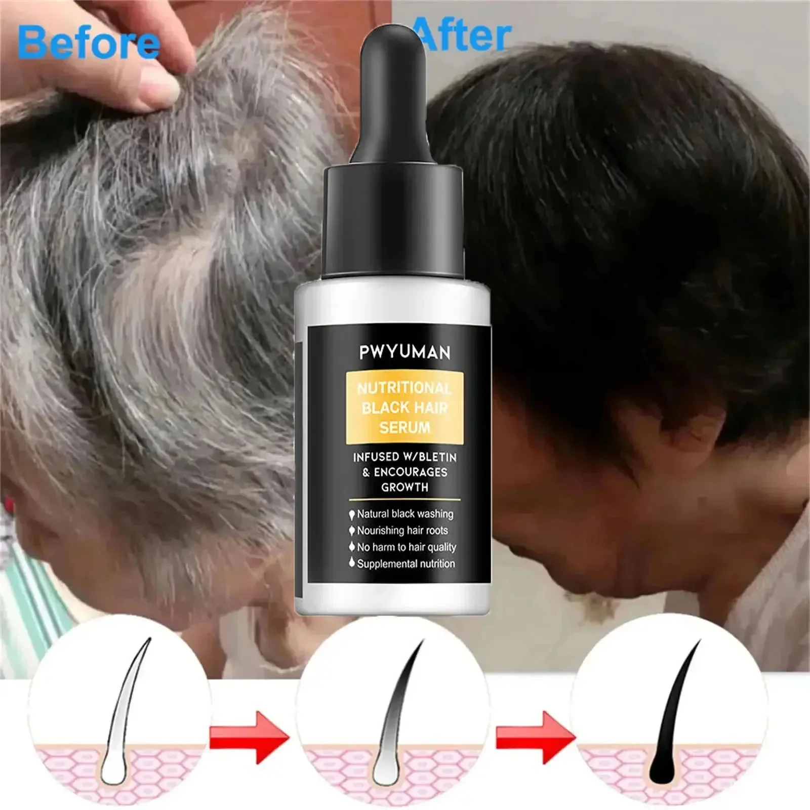 Gray White Hair Treatment Serum White To Black Natural Color Anti Hair Loss Repair Damaged Hair Beauty Health Care For Men Women пульсоксиметр на палец jet health po 2 white