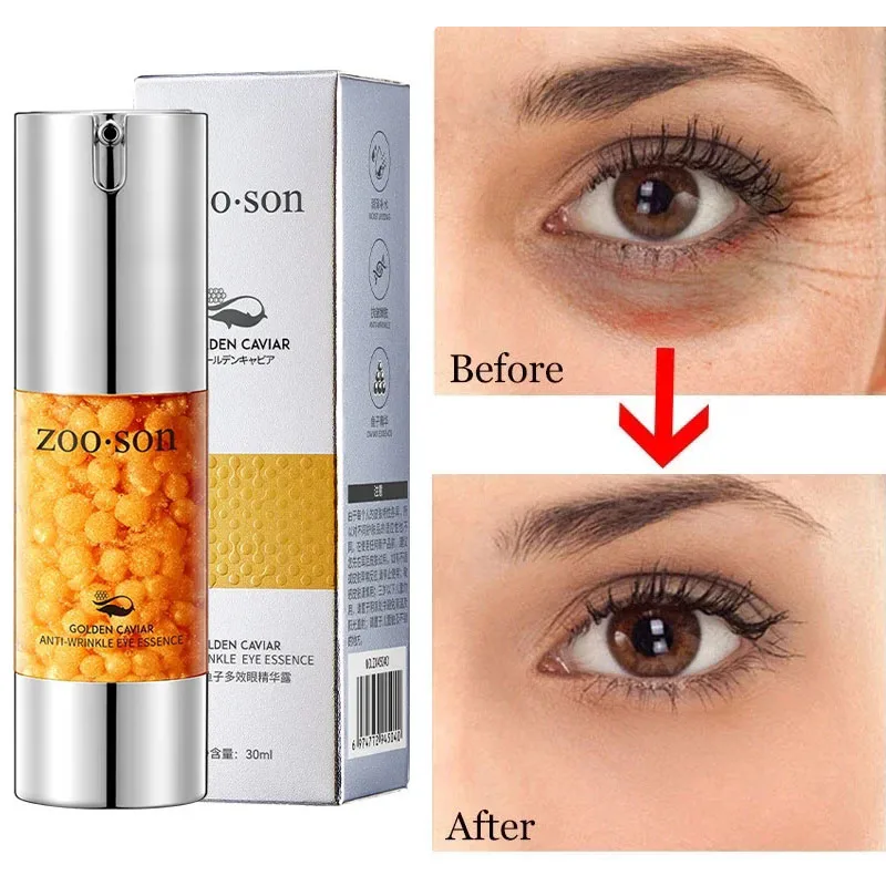 Eye Cream Dark Circles Remover Eye Bags Gold Caviar Firm Moisturizing Reduces Fine Line Anti Wrinkle Skin Care