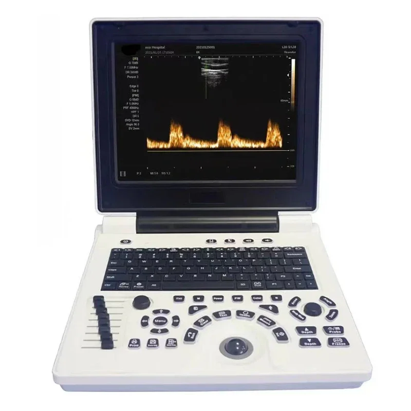 Ultrasound Scanner Veterinary Machine Laptop 12 Inch Portable Black White Doppler Farm Animals Pregnancy Convex Probes, with USB 2