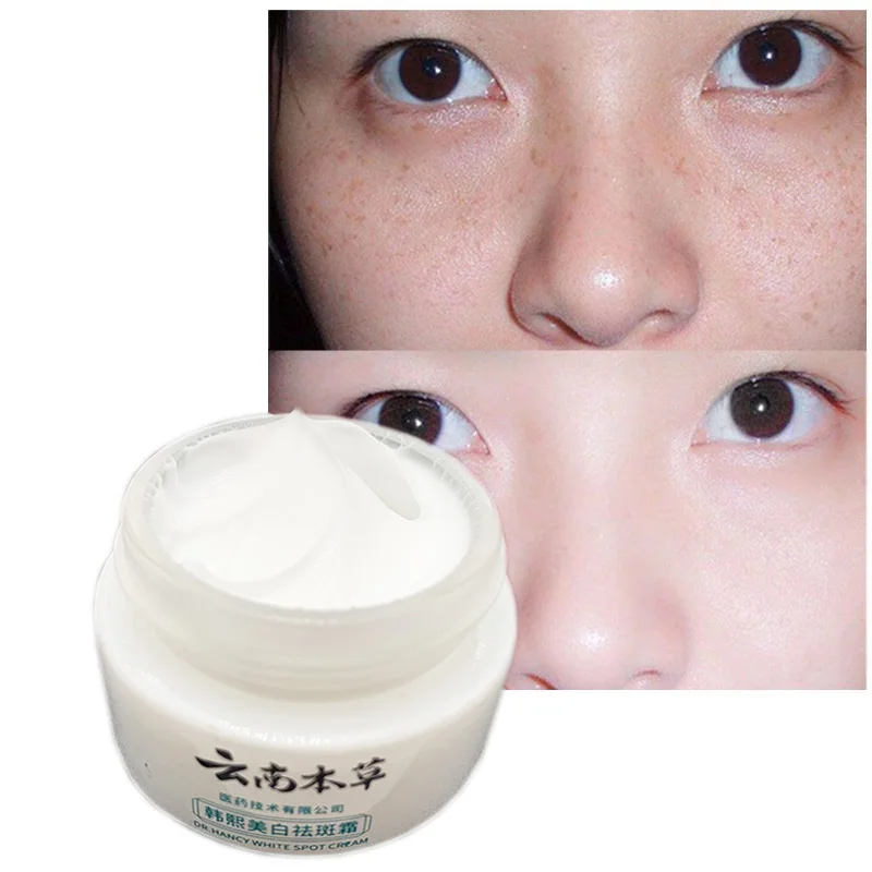 Whitening Freckles Cream Remove Melasma Dark Spot Lightening Melanin Removal Melasma Remover Moisturize Brighten Face Skin Care
