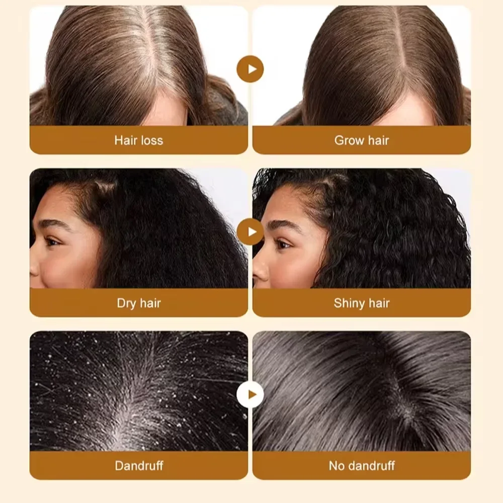 Fast Hair Growth Set Batana Oil Traction Alopecia HairS Mask Anti Break Loss Hair Growth Oil Baldness Treatment Hair Health Care 4 Fast Hair Growth Set Batana Oil Traction Alopecia HairS Mask Anti Break Loss Hair Growth Oil Baldness Treatment Hair Health Care - Image 4