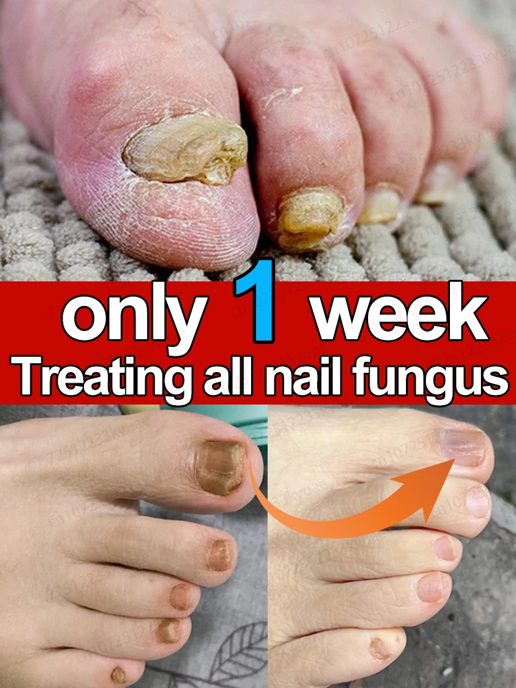 Foot Serum with Organic Essential Oil 7-Day Repair