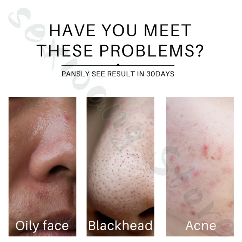 100ML HBN Amino Acid Deep Cleanses The Skin, Shrinks Pores, Controls Oil, and Is Gentle and Non-irritating for Sensitive Skin 4