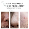 100ML HBN Amino Acid Deep Cleanses The Skin, Shrinks Pores, Controls Oil, and Is Gentle and Non-irritating for Sensitive Skin 4