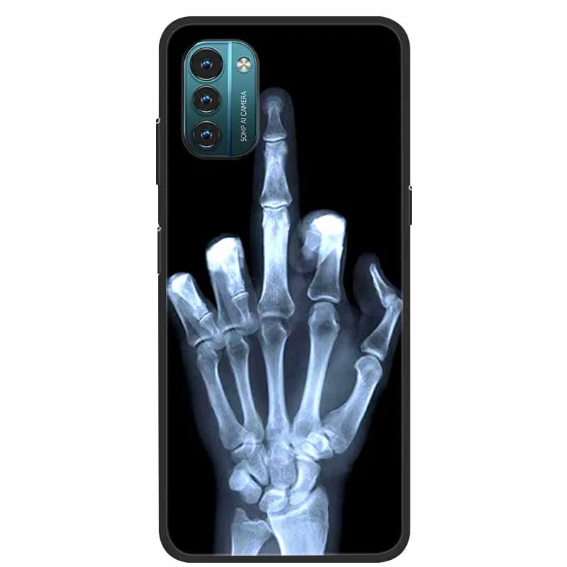 G21 G11 Cover per Nokia G21 Custodia in silicone verniciato morbido protettivo nero Coque per Nokia G11 Custodie G 11 Paraurti per NokiaG21 Carino  202192403