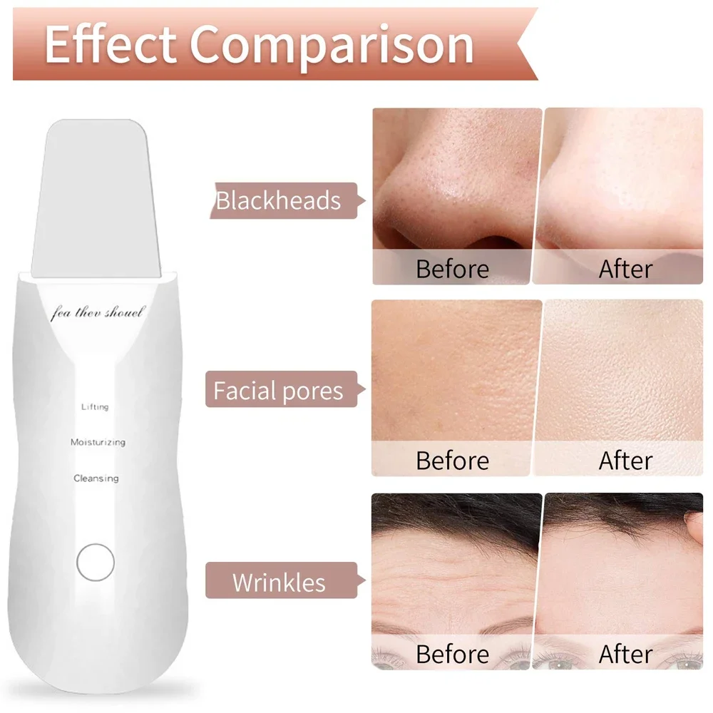 Facial Scrubber Electric Skin Scrubber Peeling Blackhead Remover Deep Face Cleaning Lifting Ion Acne Pore Cleaner Facial Spatula Shovel Cleanser