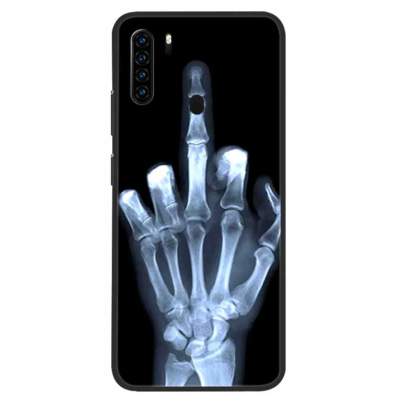 TPU Schutzhülle Für Blackview A80 PRO & A80 Plus – Schwarz, Passgenau, Stoßsicher