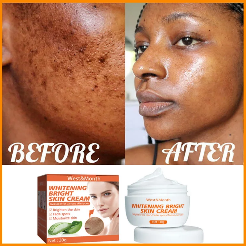 Effective Spot Remover Whitening Face Cream Dark Spots Pigment Light Skin Freckle Sunspots
