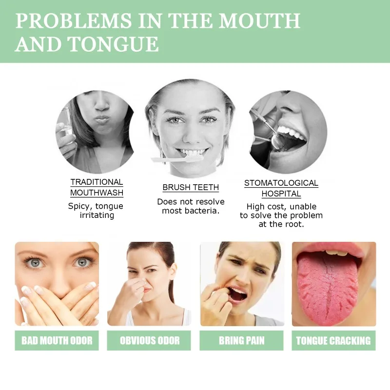 Fissured Tongue Relief Spray Teeth Clean Deodorant Prevent Calculus Remove Bad Breath Supplies Deodorizing Oral Spray 3