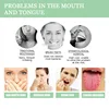Fissured Tongue Relief Spray Teeth Clean Deodorant Prevent Calculus Remove Bad Breath Supplies Deodorizing Oral Spray 3