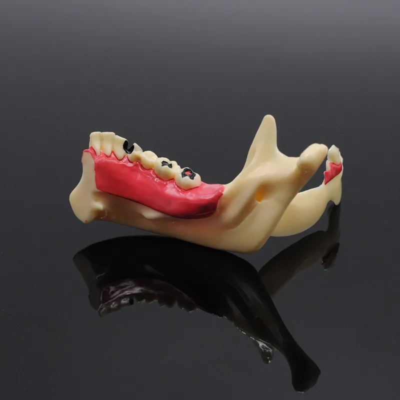 Модель стоматологической связи Mandibular 1 шт. модель для демонстрации зубов