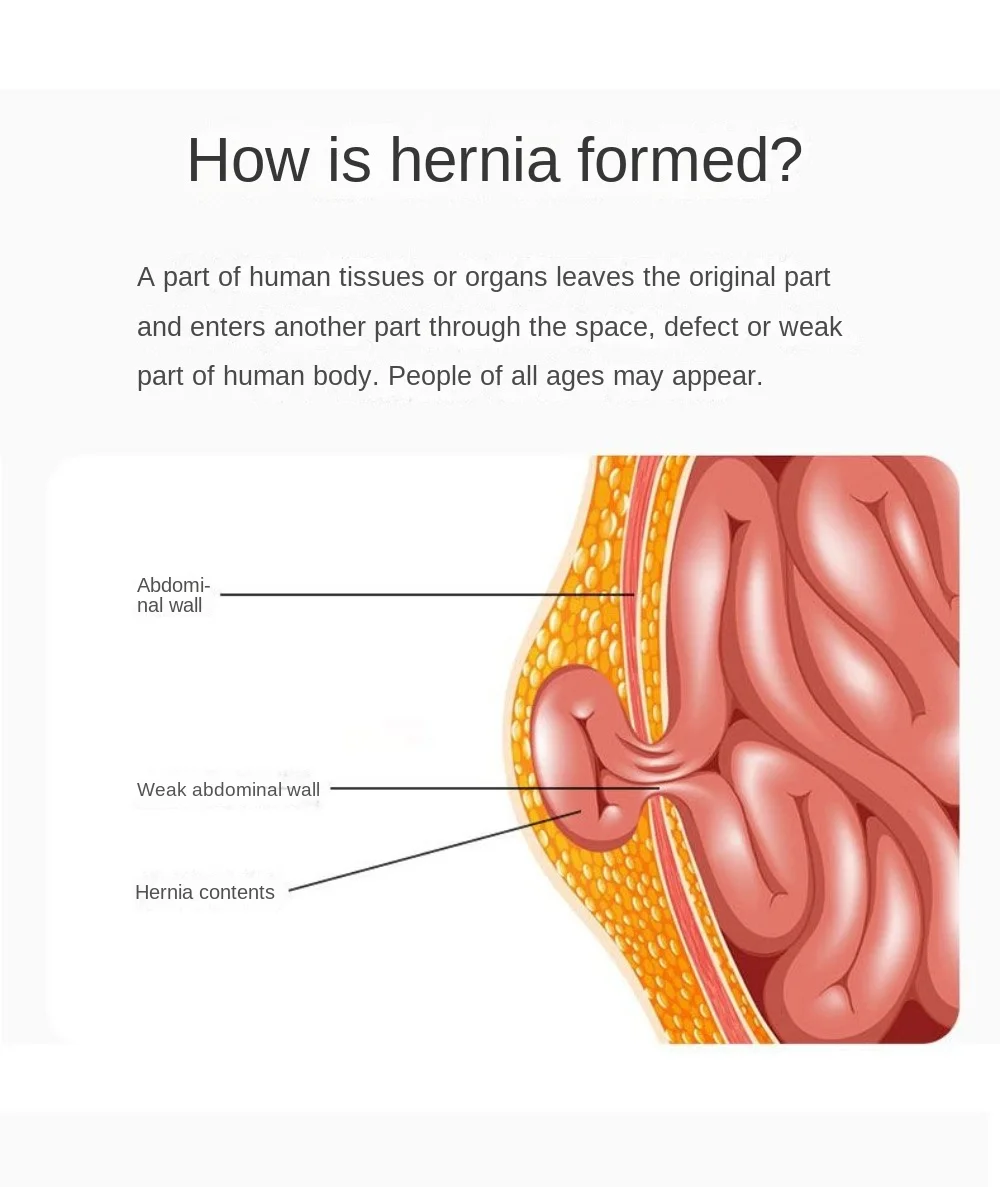 Hernia Belt Truss for Single/Double Inguinal or Sports Hernia, Hernia Support Brace for Men for Women Pain Relief Recovery Strap