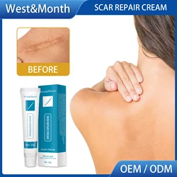 Scar Removal Cream Scar cure Cream Fade Scald Burn Old Scar Acne Marks Surgical Scar Smooth Skin Scar Removal Ointment skin care