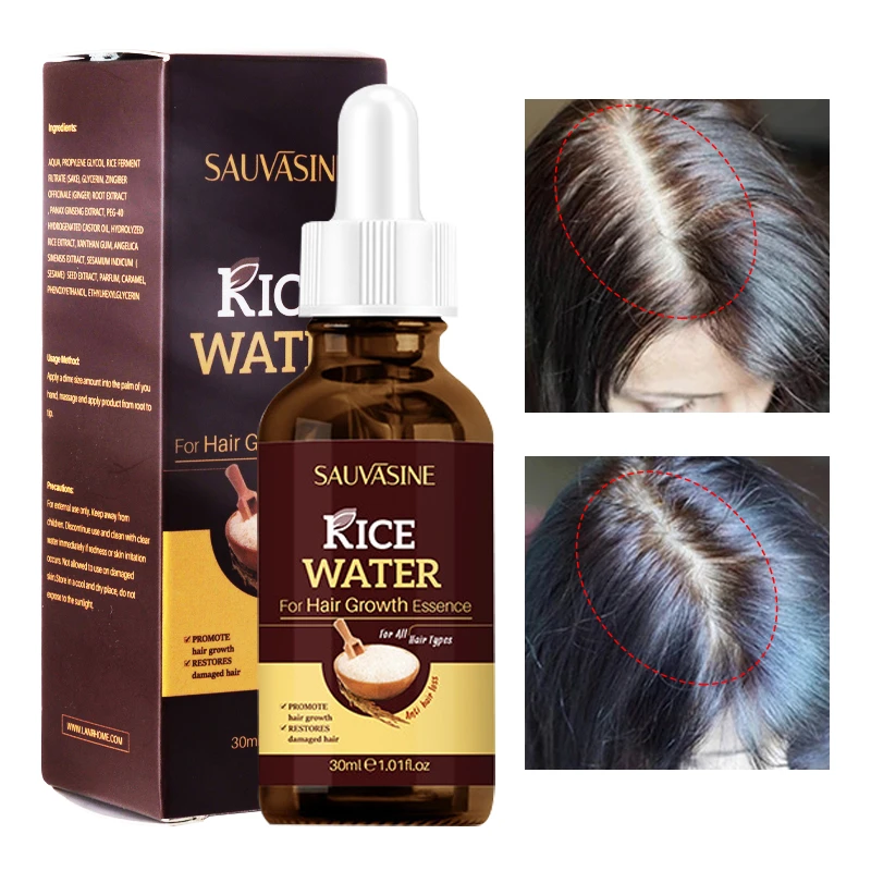 Hair Growth Serum Anti Hair Loss Scalp Care Repair Regeneration Prevent  Split Ends Oil Control Anti Dandruff Hair Care 30ml| | - AliExpress