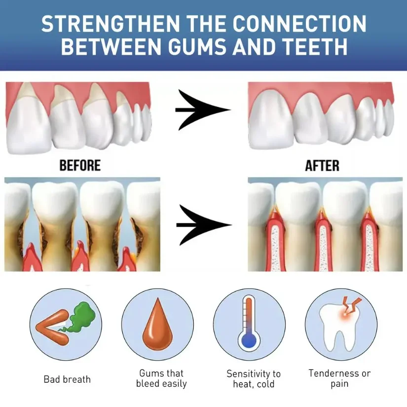 60ML Gentle Natural Gum Care Liquid Soothe Oral Discomfort Help Maintain Healthy Gum Condition Daily Oral Hygiene Care - 4