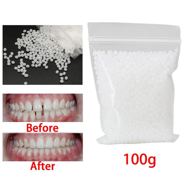 2023 Temporary Tooth Repair Beads Missing Broken Teeth Dental Tooth Filling  Material Food Grade False Teeth Solid Glue Denture - AliExpress