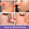 Remove Large Pores Serum Lactic Acid Facial Pore Shrinking Repairing Products Pore Minimizing Firming Smooth Korean Skin Care. 3