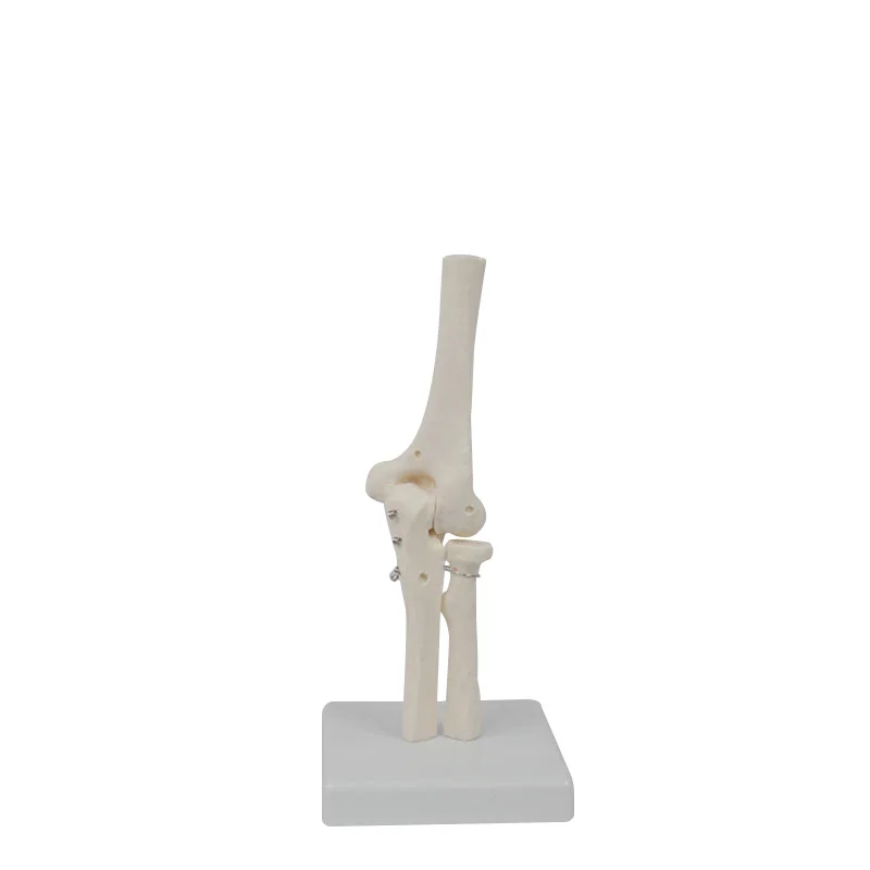 Human Elbow Joint Anatomy Model Medical Science Teaching Resources