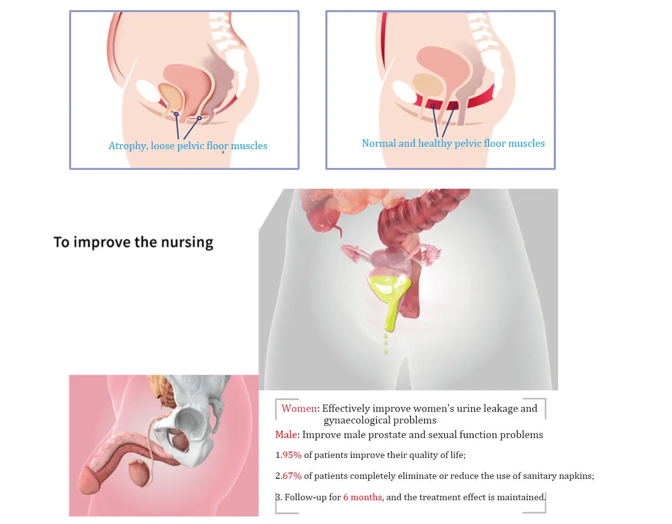 Newest Ems Pelvic Floor Muscle Exerciser Incontinence Repair Ems Chair Pelvic Floor Urinary Device