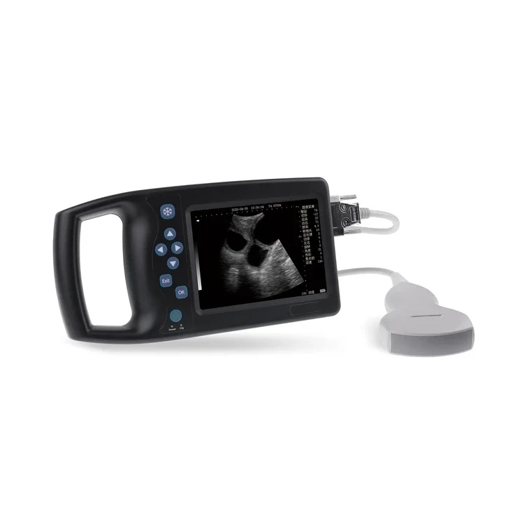 

Good Quality Color Doppler Portable Price Mobile Ultrasound Scanner