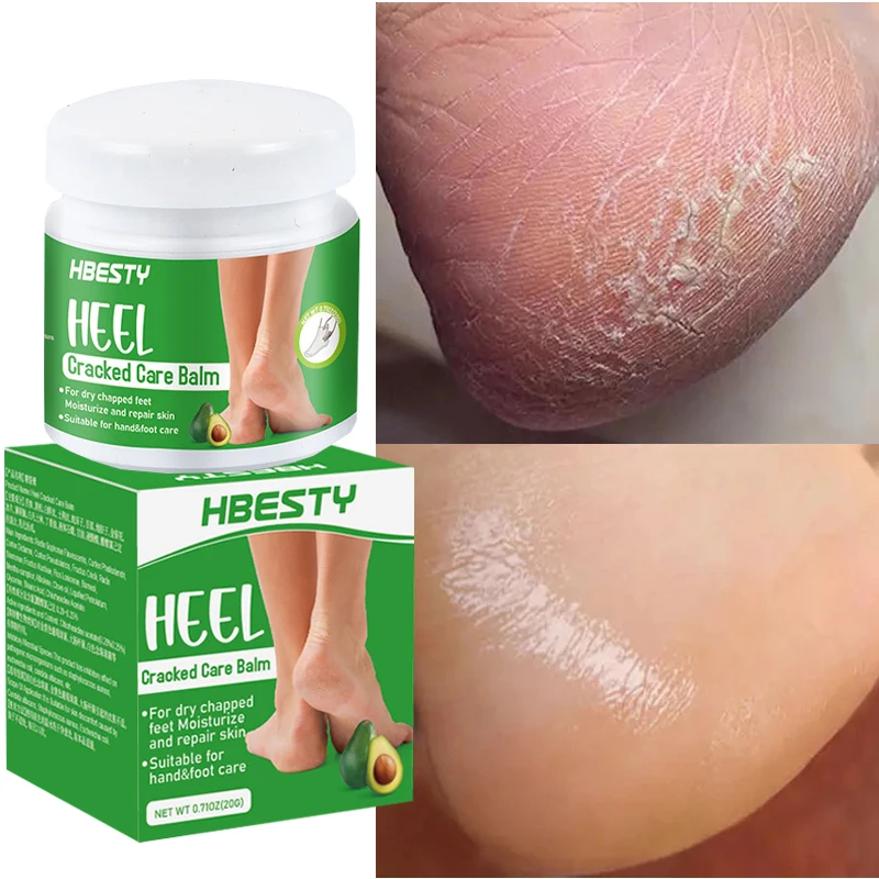 Рисунок 3 - Крем травяной для удаления трещин и зуда на пятках