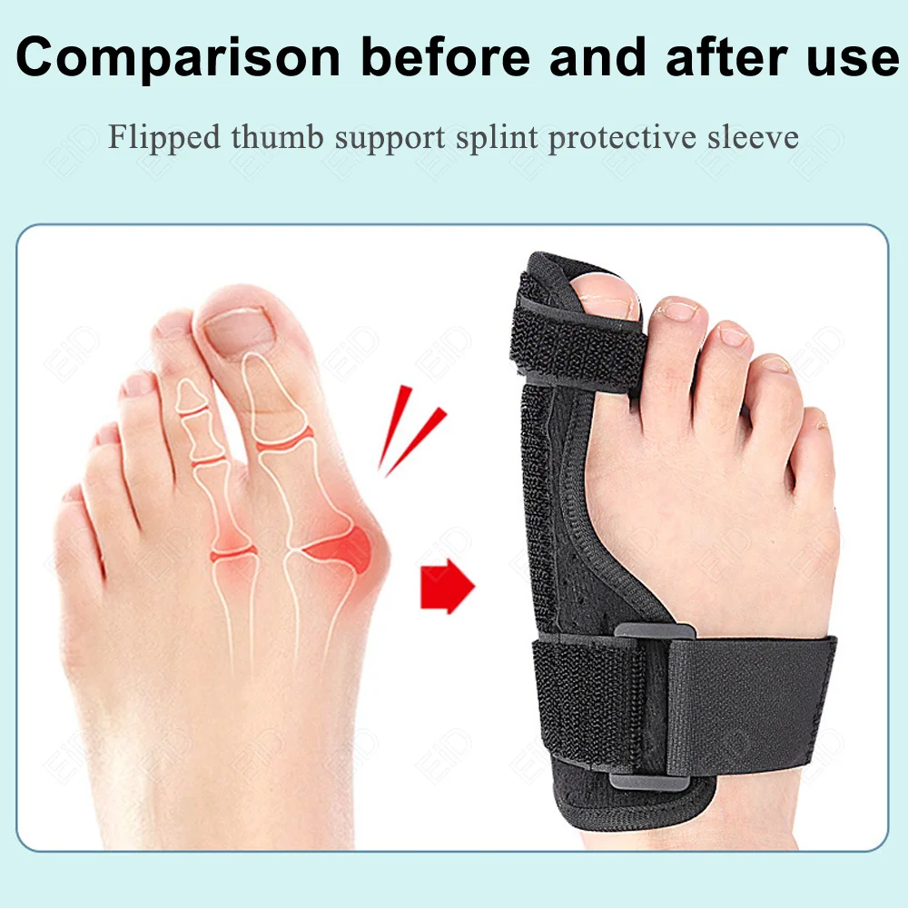 Zehen Bunion Splint Corrector Big Toe Hallux Valgus Glätteisen Bunion Fußpflege Daumenversteller Korrekturverband Schmerzlinderung – Detail 5