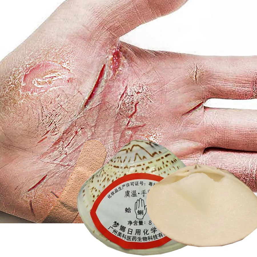 Traditional Chinese Clam Oil Anti-Drying Crack Foot Moisturize Cream Hand Heel Cracked Repair Removal Dead Skin Callus Care Mask